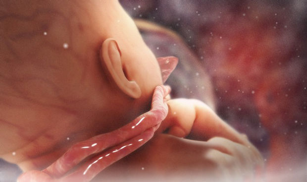 SESIÓN 17. Anomalías de las membranas fetales y de la placenta