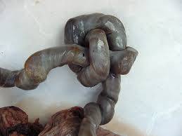 SESIÓN 17. Anomalías de las membranas fetales y de la placenta