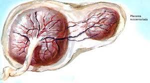 SESIÓN 17. Anomalías de las membranas fetales y de la placenta