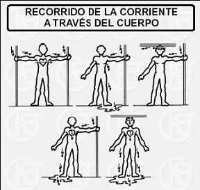 EFECTOS FISIOLOGICOS DE LA CORRIENTE ELECTRICA EN EL CUERPO HUMANO