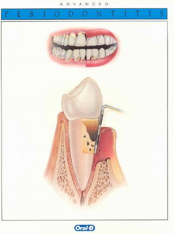 ENVEJECIMIENTO DE LOS TEJIDOS DENTALES