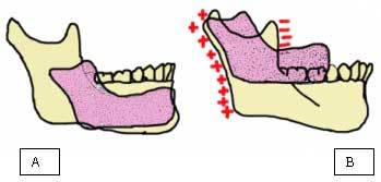 DESARROLLO DE LA CARA, FAUCES Y DIENTES.