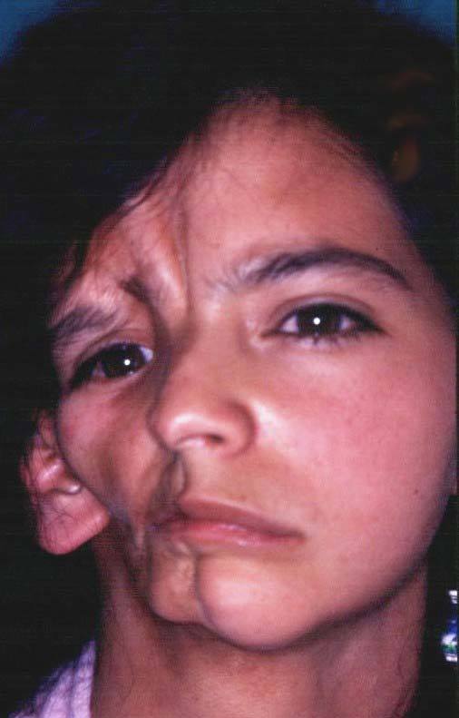 DESARROLLO DE LA CARA, FAUCES Y DIENTES.