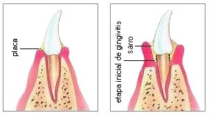 DESARROLLO DE LA CARA, FAUCES Y DIENTES.