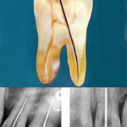 DESARROLLO DE LA CARA, FAUCES Y DIENTES.