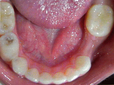 DESARROLLO DE LA CARA, FAUCES Y DIENTES.