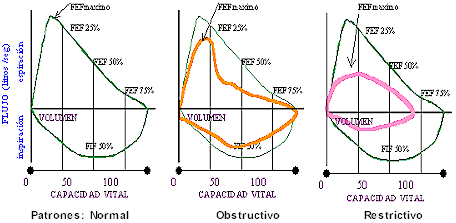 Espirometría completo
