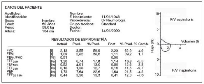 Espirometría completo