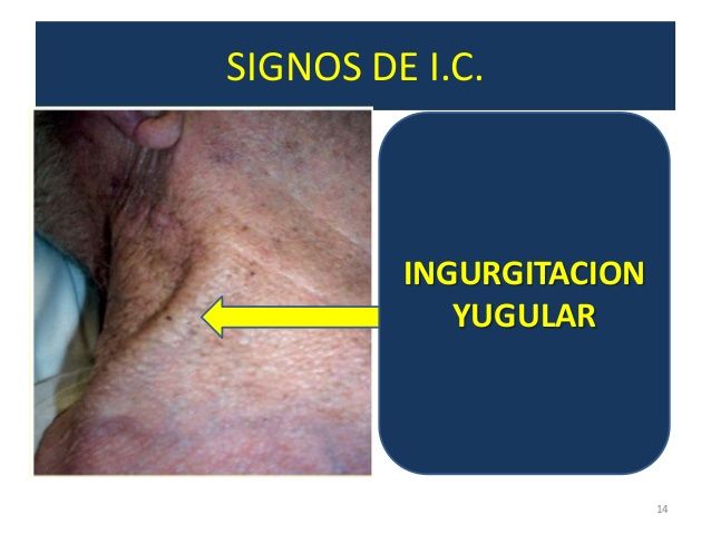 semiologia del cuello