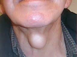 semiologia del cuello