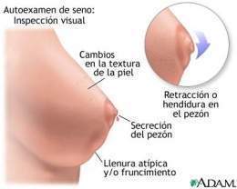 Enfermedades Beningnas de la Mama