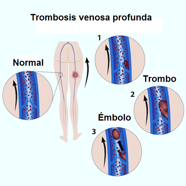 Evaluación preoperatoria y manejo postoperatorio