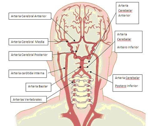 ACCIDENTE CEREBRO VASCULAR