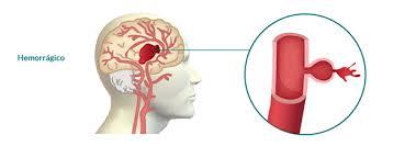 ACCIDENTE CEREBRO VASCULAR