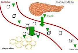 Diabetes mellitus (etiología)