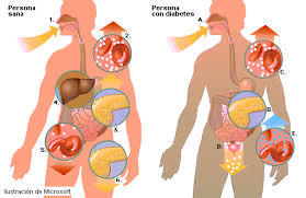 Diabetes mellitus (etiología)