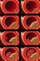Diabetes mellitus (etiología)
