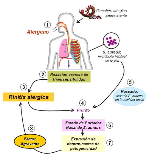 AFECCIONES DE LAS VIAS RESPIRATORIAS
