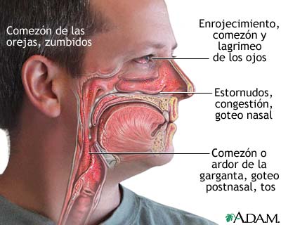 AFECCIONES DE LAS VIAS RESPIRATORIAS