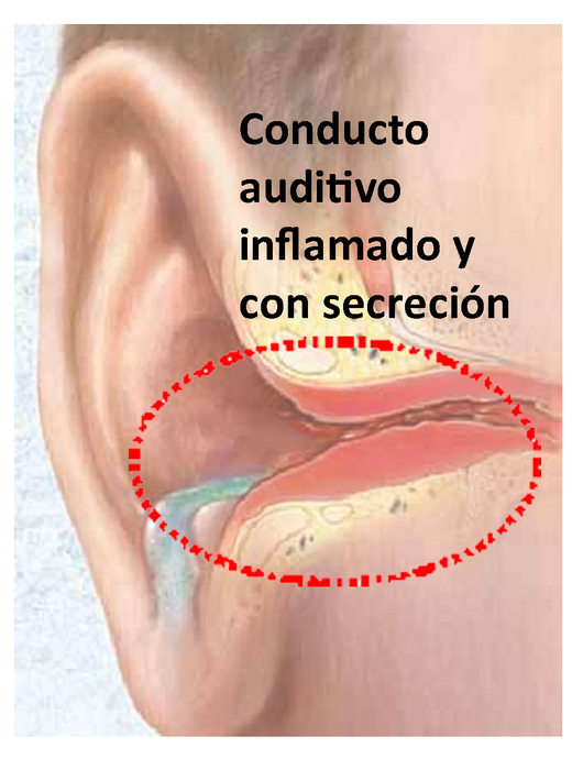 AFECCIONES DE LAS VIAS RESPIRATORIAS