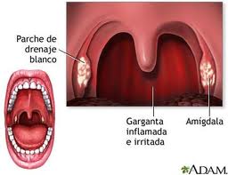 AFECCIONES DE LAS VIAS RESPIRATORIAS
