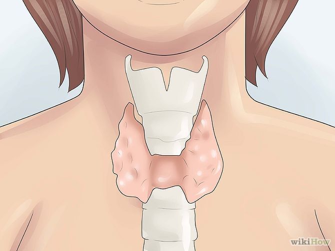 PUBERTAD Y AMENORREA