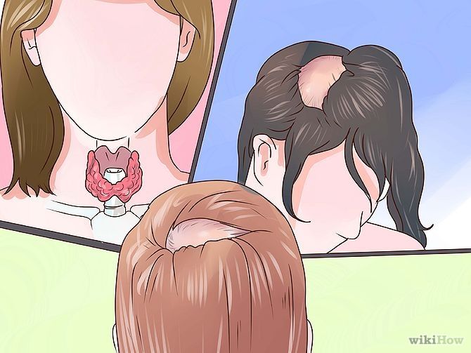 PUBERTAD Y AMENORREA