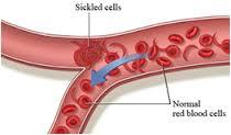 Alteraciones gastrointestinales y hematológicas durante le embarazo CONTINUACIÓN