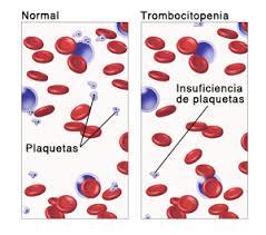 Alteraciones gastrointestinales y hematológicas durante le embarazo CONTINUACIÓN