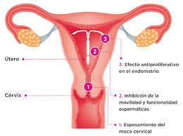 Anticoncepción médica, métodos mecánicos y quirúrgicos