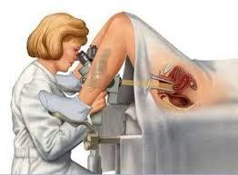 Enfermedad intraepitelial de cervix, vagina y vulva