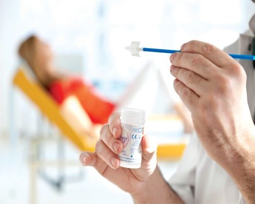 Enfermedad intraepitelial de cervix, vagina y vulva