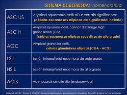 Enfermedad intraepitelial de cervix, vagina y vulva