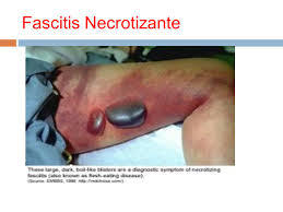 Evaluación preoperatoria y manejo postoperatorio