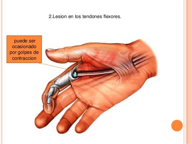 Sistema Nervioso