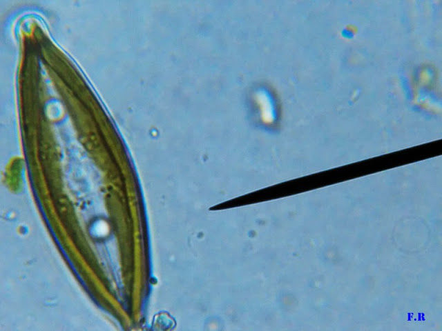 Muestra de agua de las piscinas de la zarcilla
