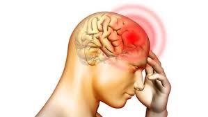 Daño Cerebral