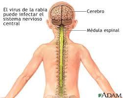 Daño Cerebral