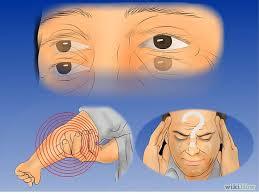 Daño Cerebral