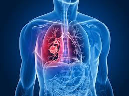 RESPIRACION EN LOS SERES VIVOS