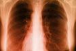 RESPIRACION EN LOS SERES VIVOS