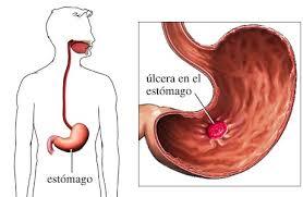 COMPOSICIÓN QUÍMICA, PROPIEDADES Y USOS DE LA ORTIGA