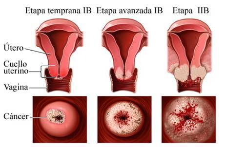LINEAS DE ACCIONES DEL ESTADO PARA TRABAJAR LA SALUD SEXUAL Y REPRODUCTIVA