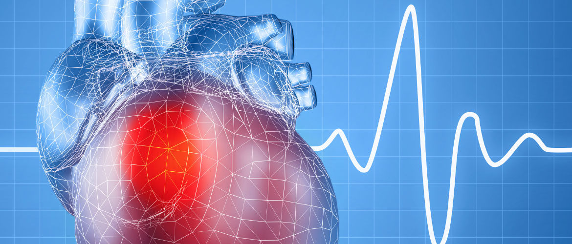 Fisioterapia cardiovascular