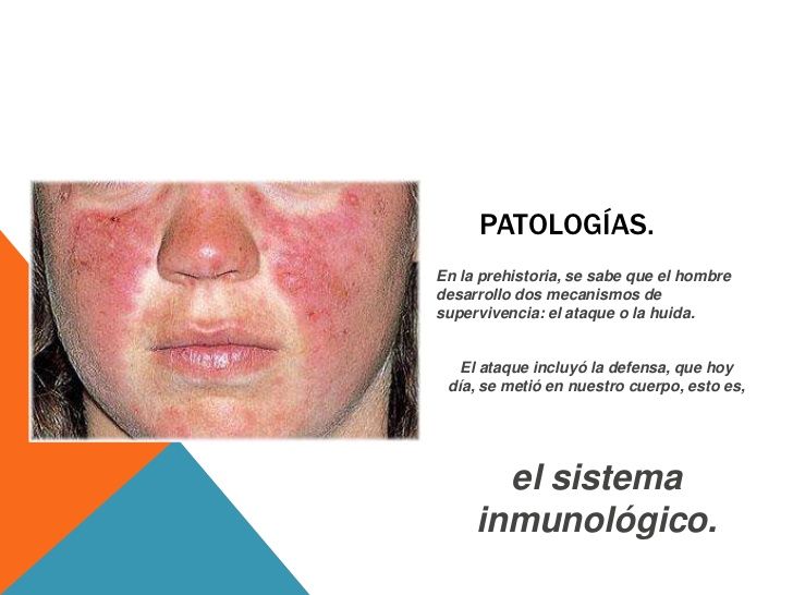 inmunologia