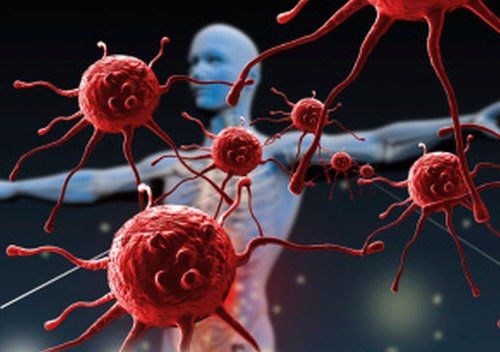 Lupus eritematoso sistemico