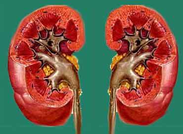 Lupus eritematoso sistemico