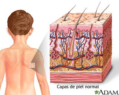 Lupus eritematoso sistemico
