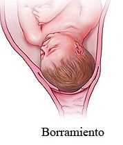 Embarazo pretérmino, postérmino y retardo en el crecimiento