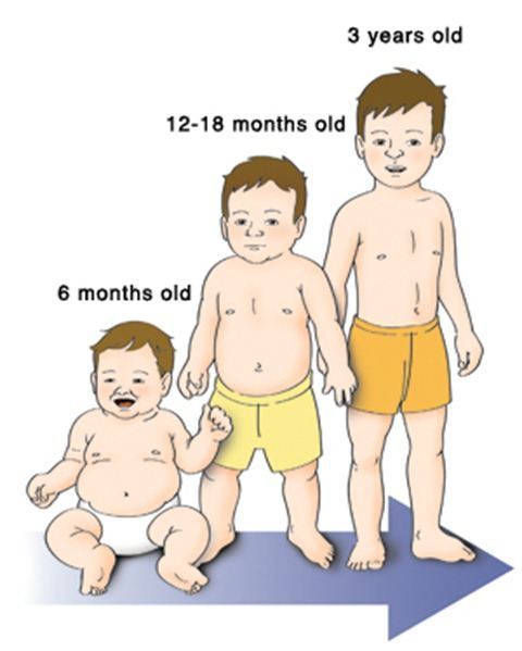 El DESARROLLO PSICOMOTOR DE LOS NIÑOS